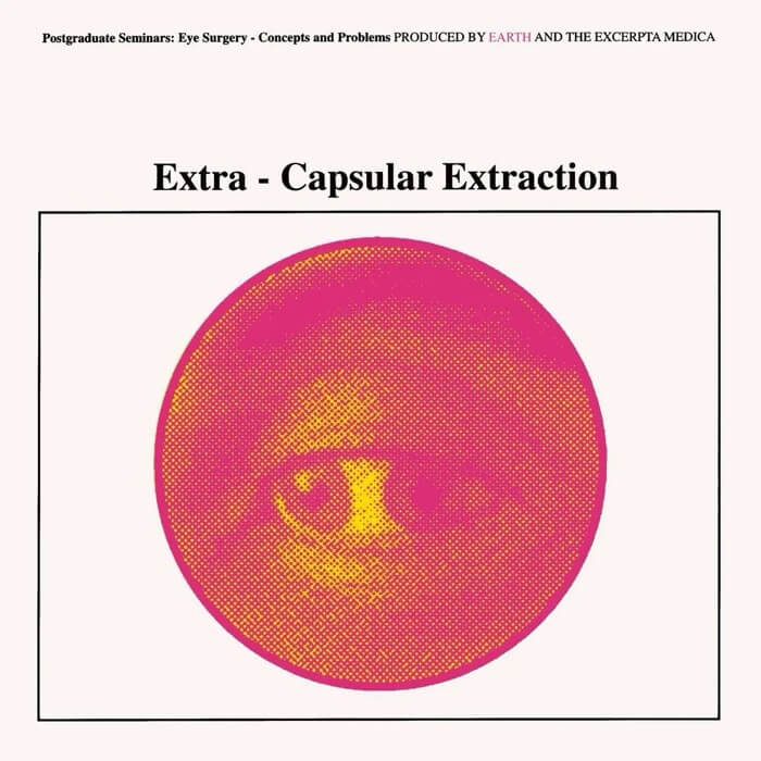 Extra-Capsular Extraction (Yellow Vinyl)